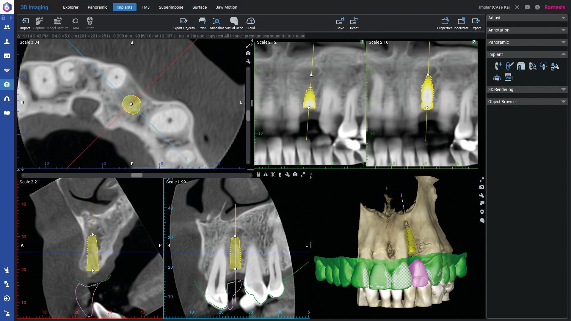 Planmeca romexis viewer недостаточно памяти для открытия 3d объема